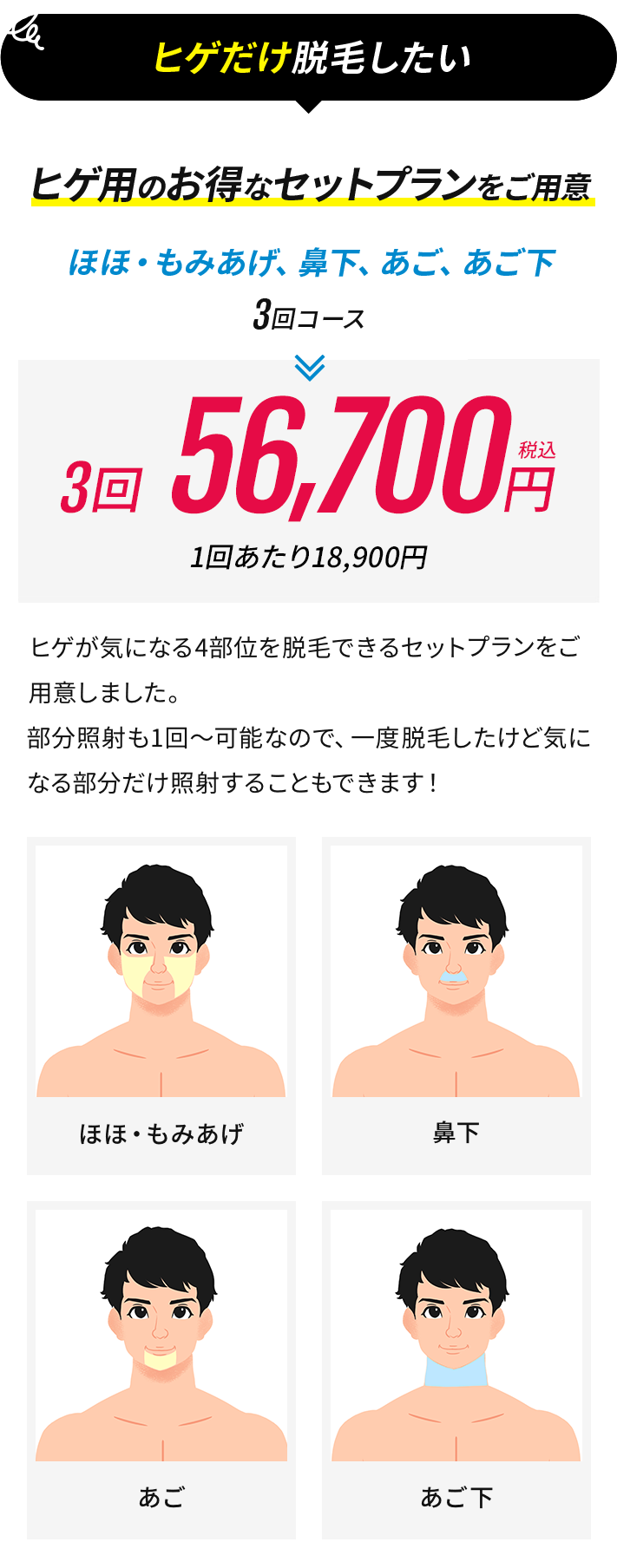 ヒゲだけ脱毛したい