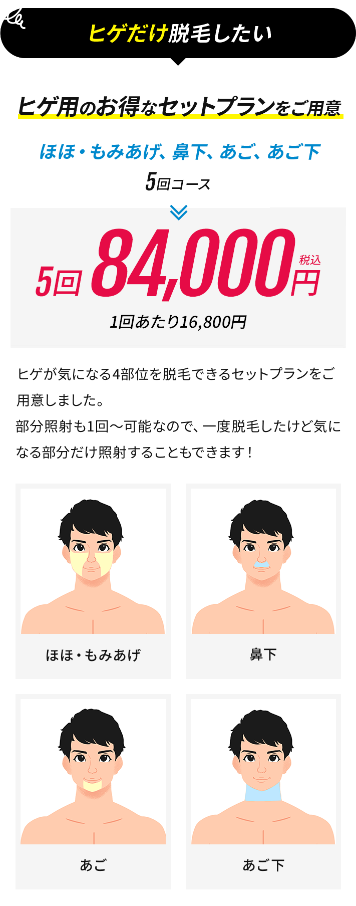 ヒゲだけ脱毛したい