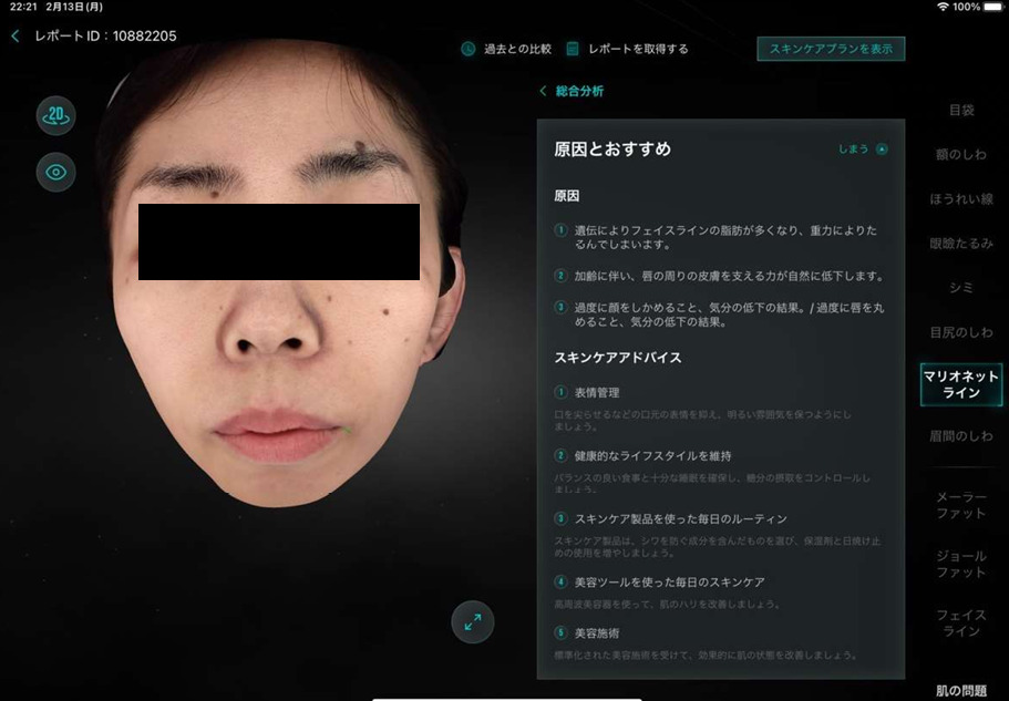 肌診断 分析画面