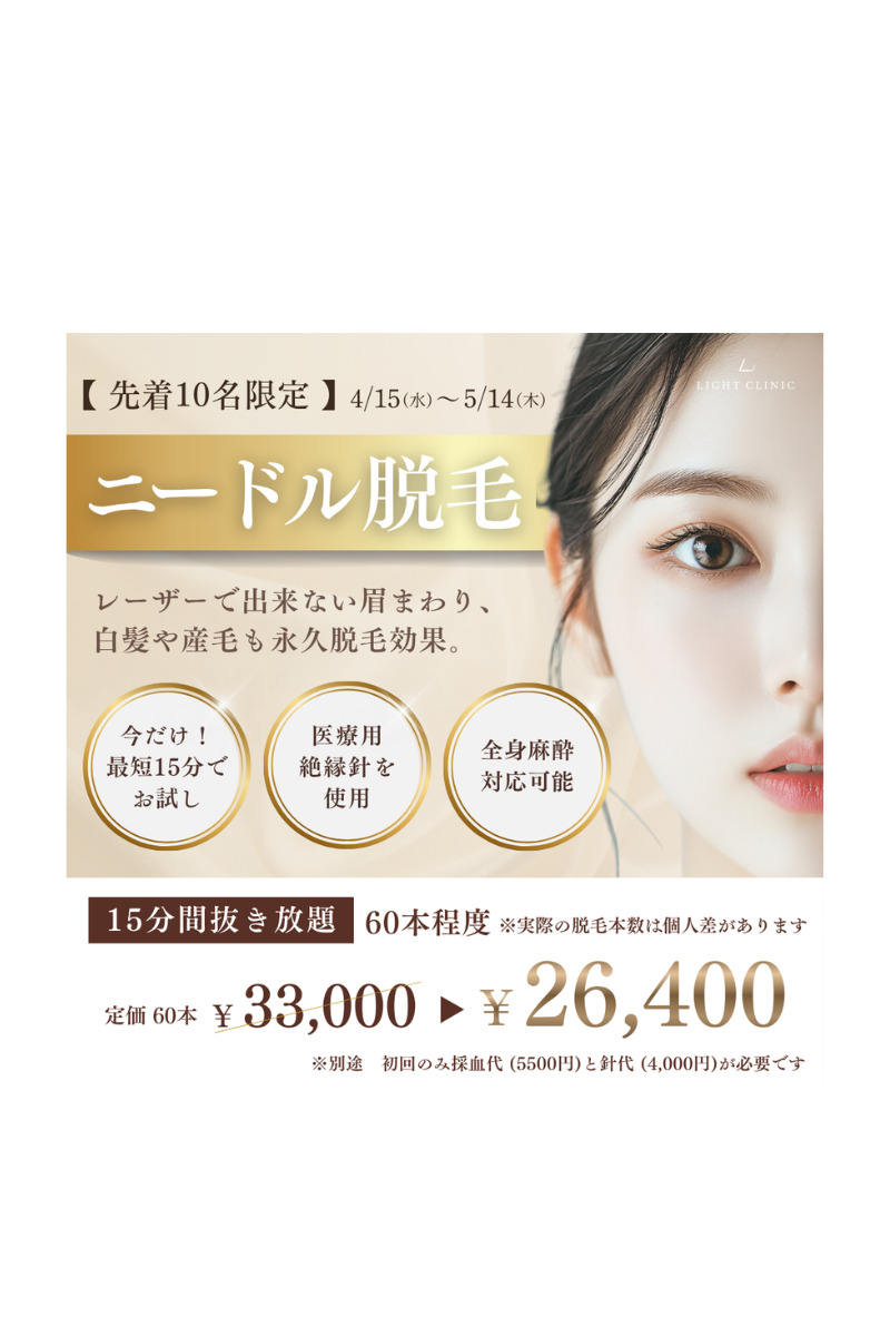 【大阪・新宿】4月15日〜5月14日まで限定ニードル脱毛キャンペーン！白髪や残り毛も確実に。