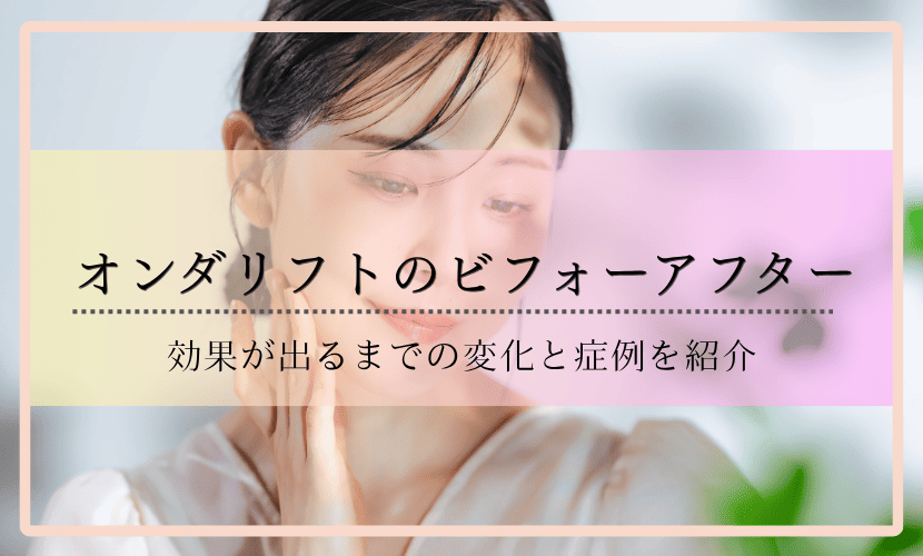 オンダリフトのビフォーアフター｜効果が出るまでの変化と症例を紹介